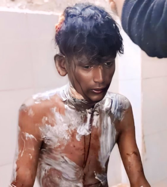 30 प्रतिशत झुलसा, बाइक भी जलकर खाक हुई, प्रेम प्रसंग के मामला 